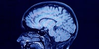 Brain head scan